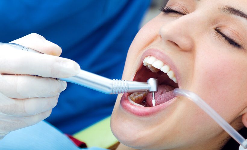 Восстановление зубов пломбированием